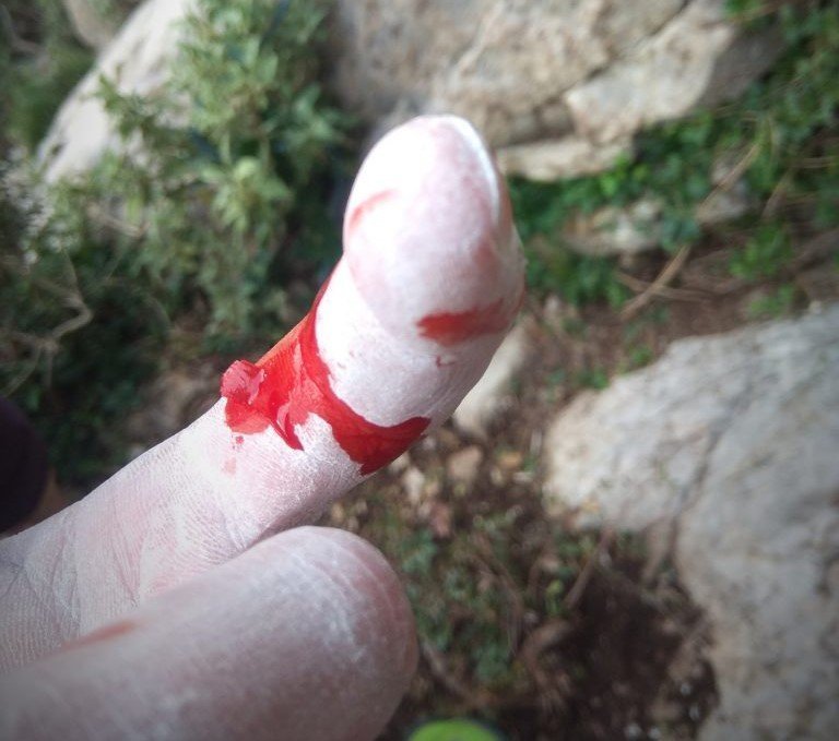 finger blood